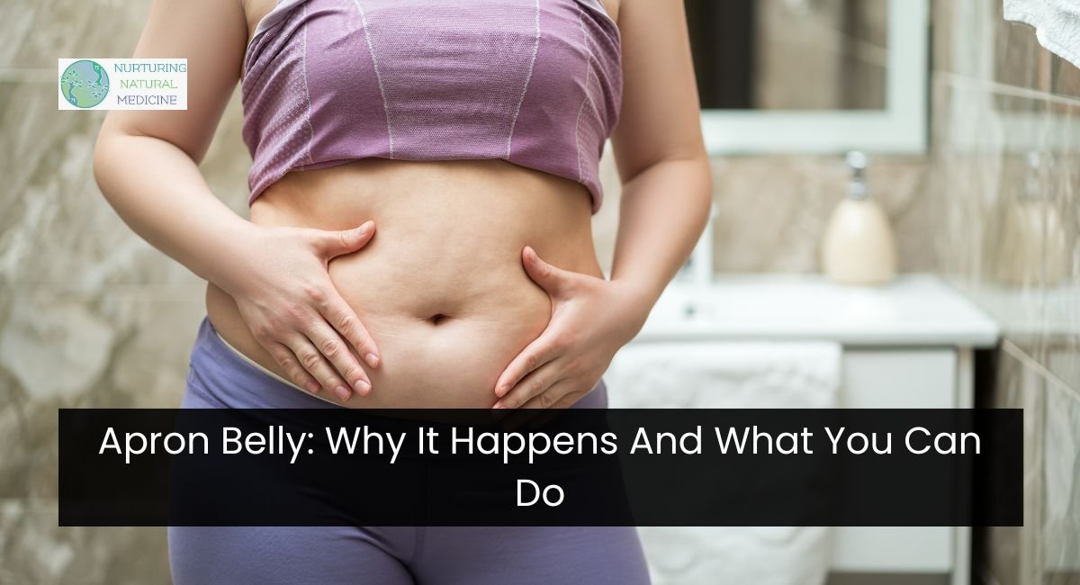 Apron Belly: Why It Happens And What You Can Do